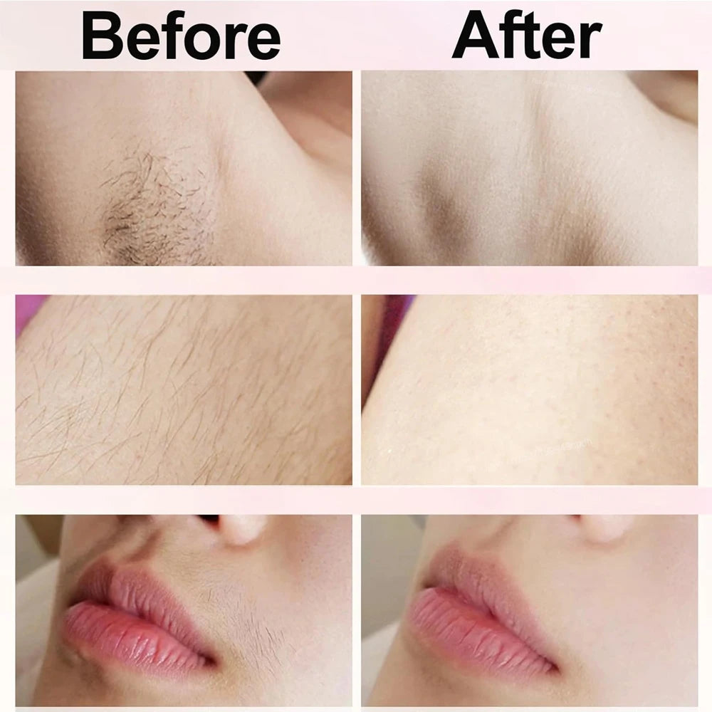 Hair Remover SilkTouch™ 2-in-1 — Flawless Skin, Effortless Beauty