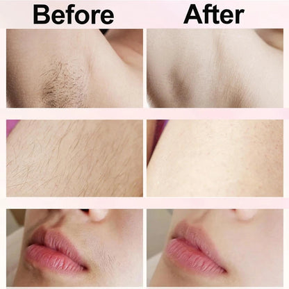 Hair Remover    SilkTouch™ 2-in-1 — Flawless Skin, Effortless Beauty